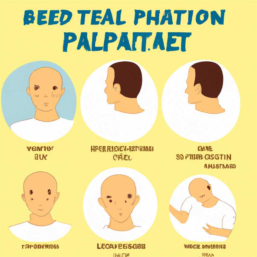 Алопеция у мужчин: подробности и способы лечения