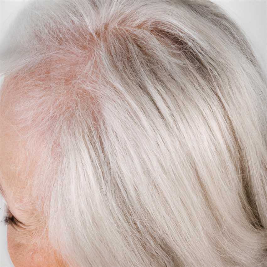 Проблема №1: Причины появления желтизны у белых волос