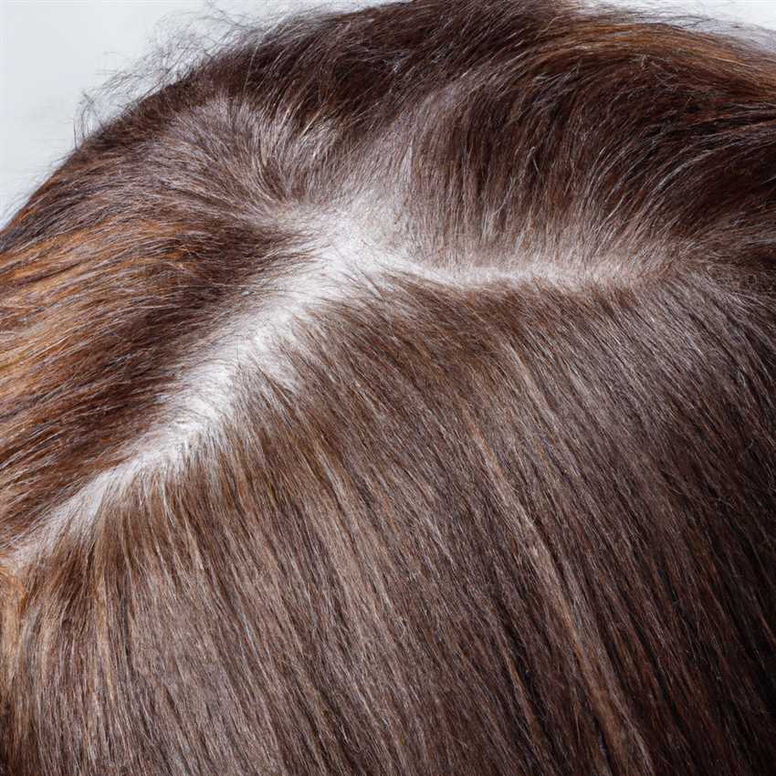 Проблемы и решения: как устранить желтизну у белых волос