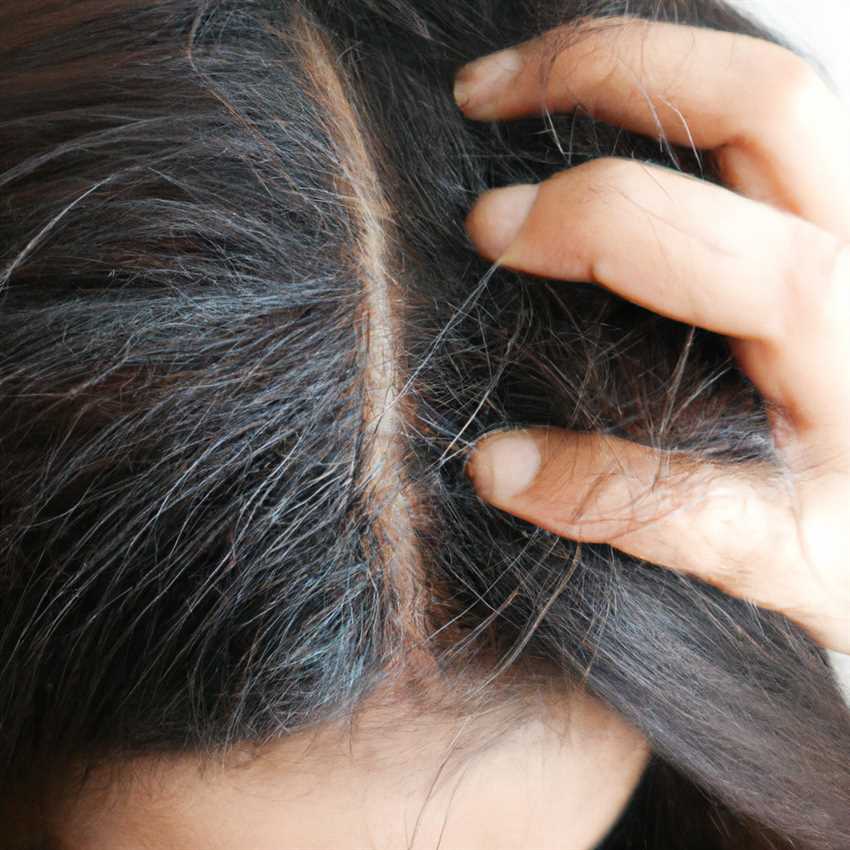 Выпадение волос у женщин: возможные причины и способы лечения.