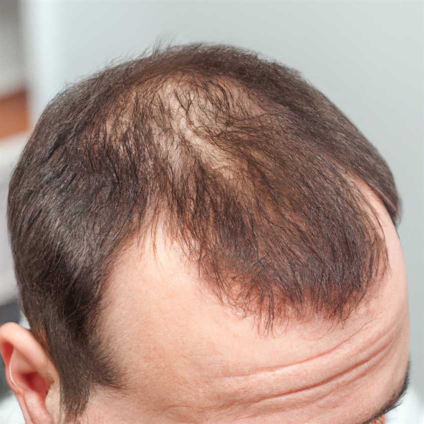 Секреты успешного восстановления волос на голове после сильного повреждения Восстановление волос на голове после сильной повреждения: секреты успешного восстановления