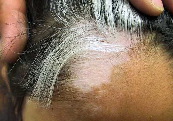 5. Защита от вредных воздействий