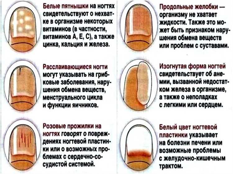 Поддерживаем здоровье ногтей в зимнее время