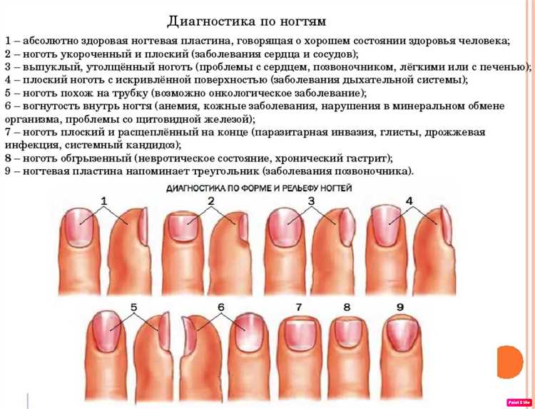 Причины эффекта льда на ногтях и как предотвратить его появление